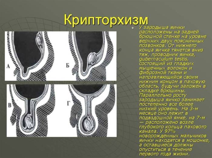 У собаки – крипторхизм, как поступить?