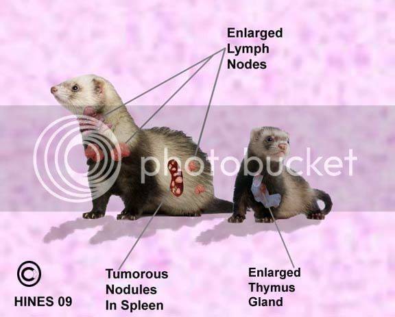 Рак брюшной полости: симптомы и признаки опухоли забрюшинного пространства, лечение и причины рака забрюшинного пространства | клиники «евроонко»