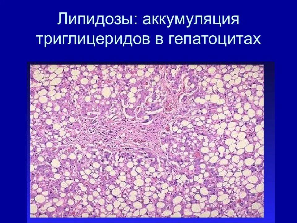 Липидоз печени у кошек: симптомы и ветеринарная диагностика, признаки и лечение заболевания. питание кота: чем кормить питомца во время недуга