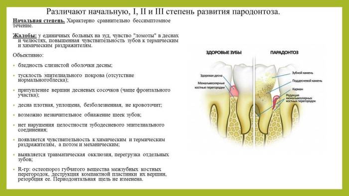 Пародонтоз зубов и десен, симптомы пародонтоза, лечение пародонтоза, пародонтоз фото