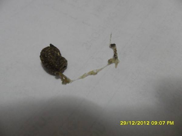 Зачем делают копрограмму? цель процедуры и расшифровка результатов * клиника диана в санкт-петербурге