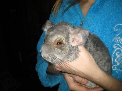 Сахарный диабет – симптомы, лечение, причины