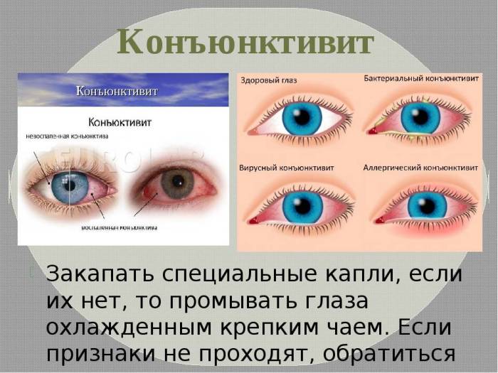 У кролика гноятся глаза: что делать и чем снять опухли?
