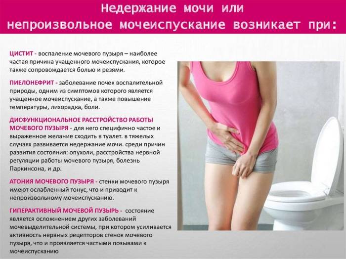 Лечение нарушений мочеиспускания | университетская клиника