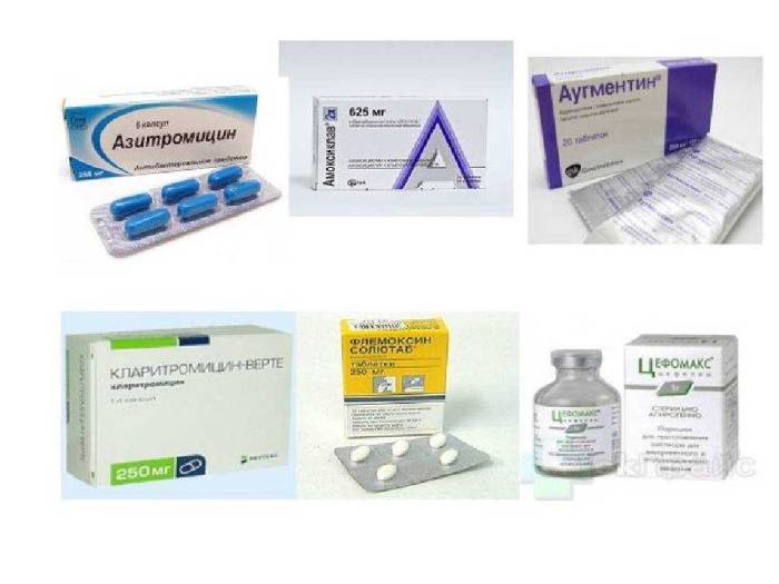 Антибиотики для кошек и котят при инфекции: список антибактериальных препаратов широкого и узкого спектра действия