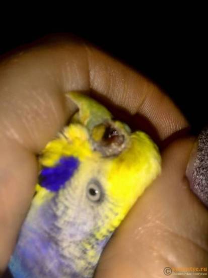 Нехватка воздуха, трудно дышать — что может вызвать данный симптом