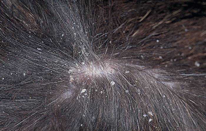 Перхоть у собаки: причины и лечение, профилактика