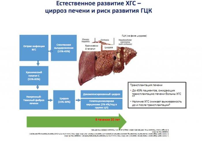 Гепатит b, цирроз печени, гепатоцеллюлярная карцинома (гцк) – причины, симптомы * клиника диана в санкт-петербурге