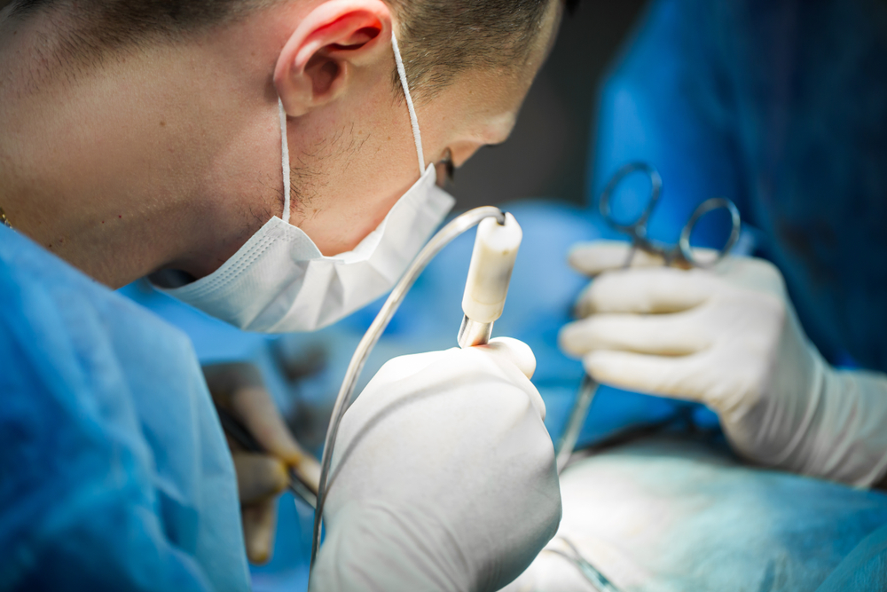 Полип в носу у кошки: причины появления и лечение назофарингеальных полипов