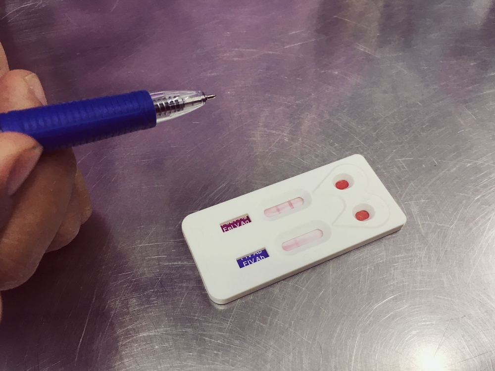 Вирусный лейкоз кошек: симптомы, диагностика, лечение и прогноз